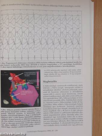 Cardiologia Hungarica 2008. szeptember