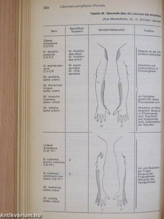 Neurologie