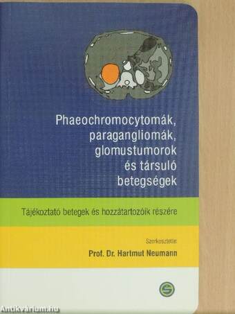 Phaeochromocytomák, paragangliomák, glomustumorok és társuló betegségek