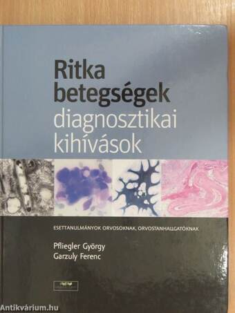 Ritka betegségek, diagnosztikai kihívások