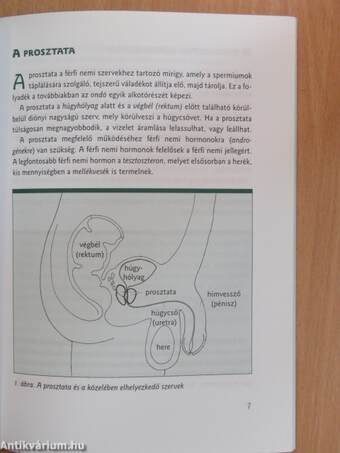 Amit a prosztatarákról tudni kell