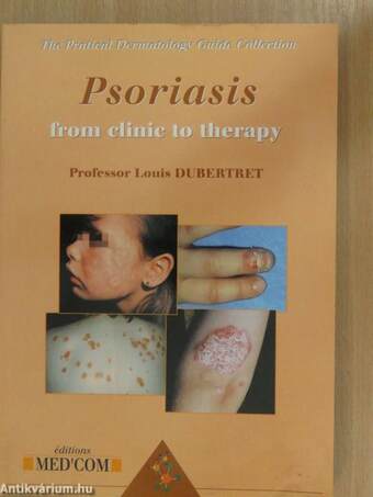 Psoriasis from clinic to therapy