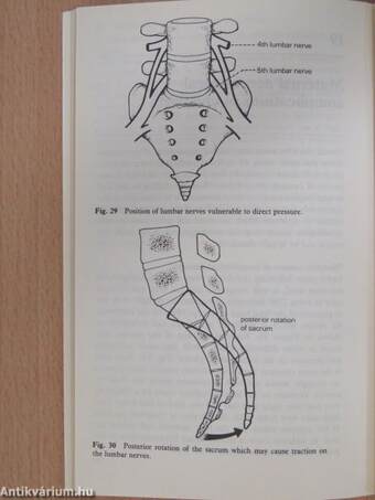 Management of Epidural Analgesia in Childbirth