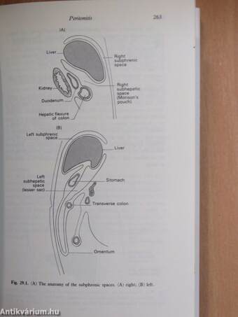 Lecture Notes on General Surgery