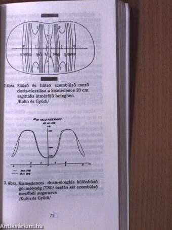 Cervix és corpuscarcinomák diagnosztikája és therápiája