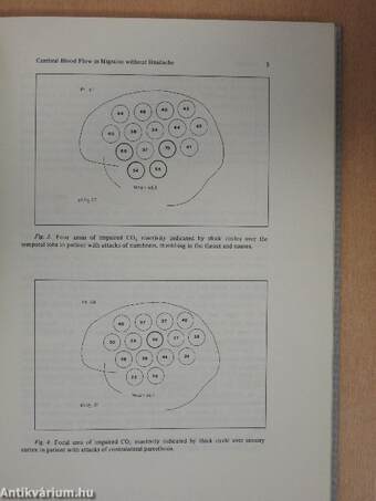 Headache Today - An Update by 21 Experts