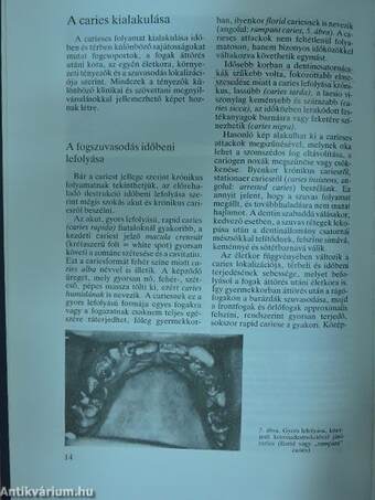 Cariologia és endodontia