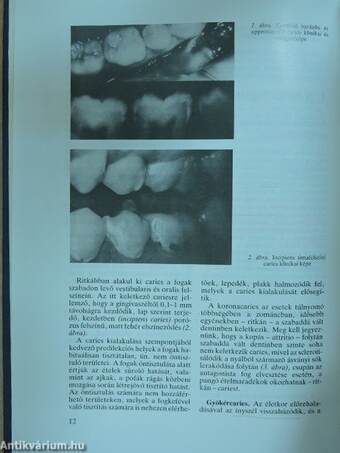 Cariologia és endodontia