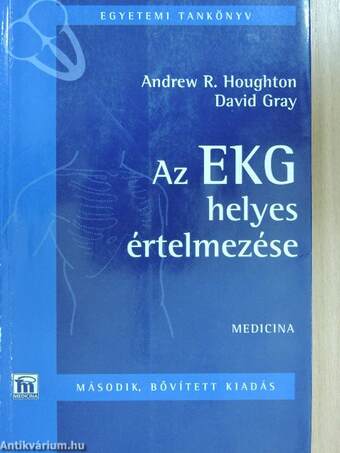 Az EKG helyes értelmezése