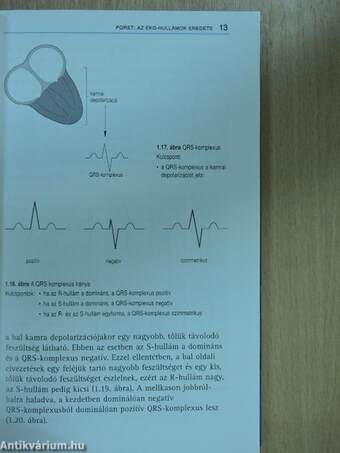 Az EKG helyes értelmezése