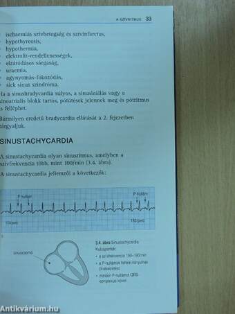 Az EKG helyes értelmezése