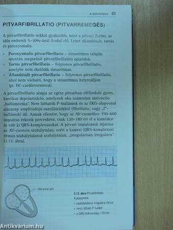 Az EKG helyes értelmezése