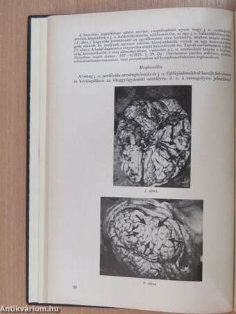 Fül-orr-gégegyógyászat 1974-1977. január-december I-II.