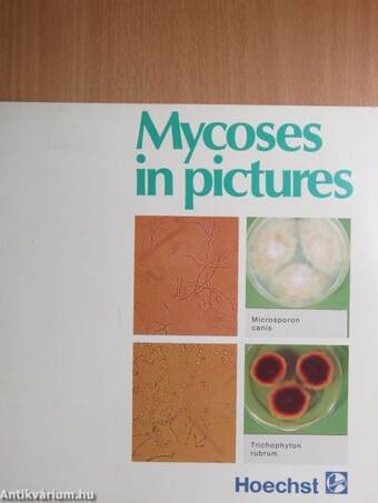 Mycoses in Pictures