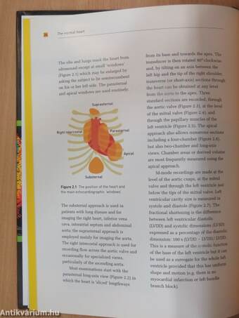 Echocardiography in clinical practice