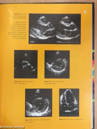 Echocardiography in clinical practice