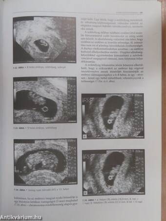 Szülészet-nőgyógyászati ultrahang-diagnosztika