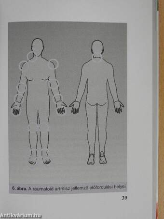 Reumatoid artritiszes betegek kézikönyve
