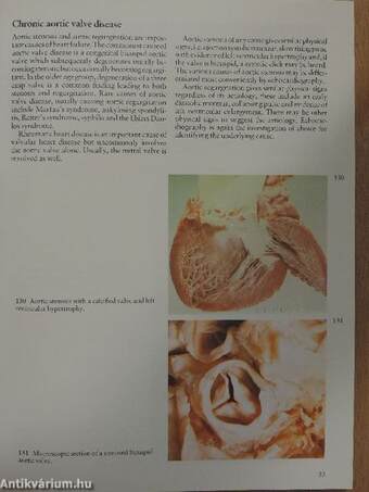 A Colour Atlas of Heart Failure