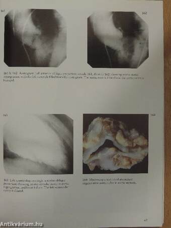 A Colour Atlas of Heart Failure