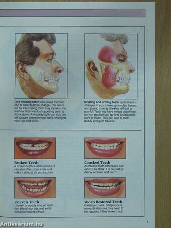 Crowns, Bridges and Partial Dentures