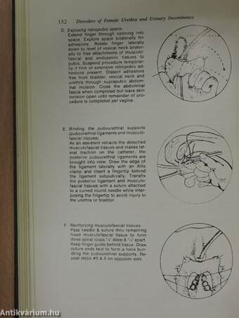 Disorders of the Female Urethra and Urinary Incontinence