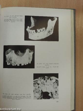 Palaeopathologia II.