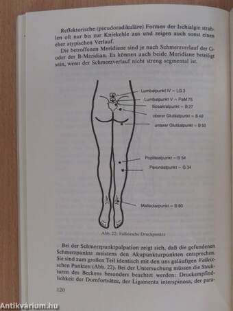 Akupunktur in der Orthopädie