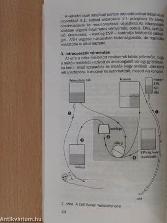 A perioperatív folyadék- és hemoterápia (dedikált példány)