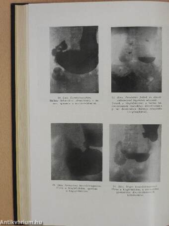 A nyelőcső-, gyomor- és bélbetegségek klinikája