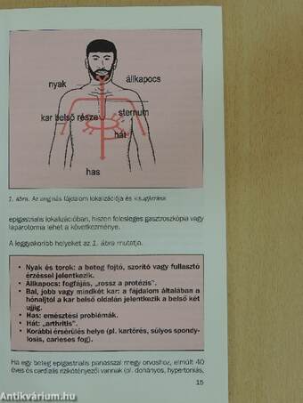 Angina pectoris