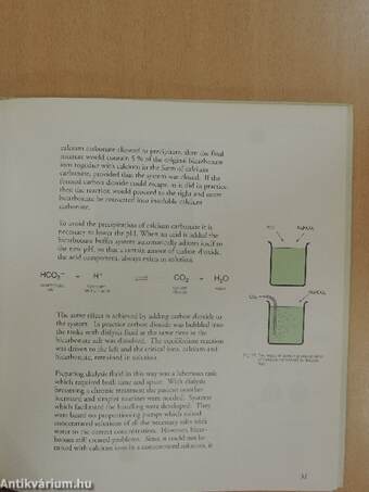 Acetate vs bicarbonate in Everyday Dialysis