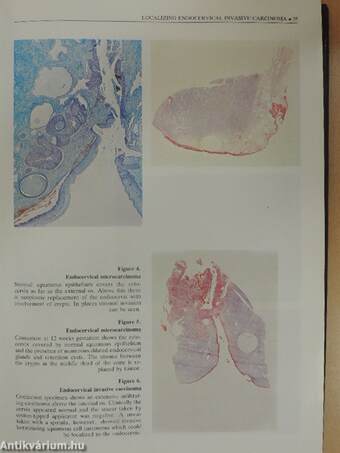 Cytology of the Uterine Cervix