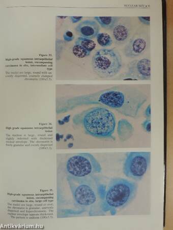 Cytology of the Uterine Cervix