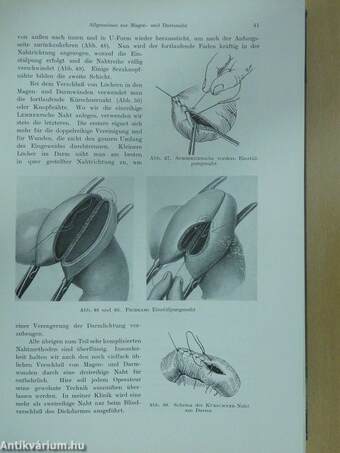 Chirurgische Operationslehre III.