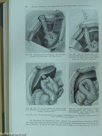 Chirurgische Operationslehre III.