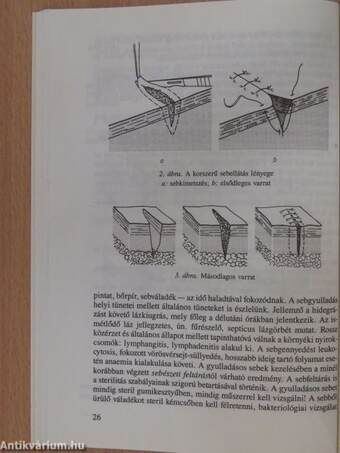 Klinikai ismeretek a sebészet köréből ápolónők részére