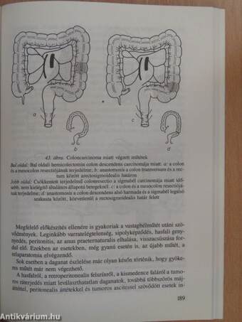 Klinikai ismeretek a sebészet köréből ápolónők részére