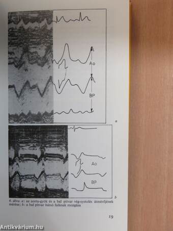 Echocardiographia