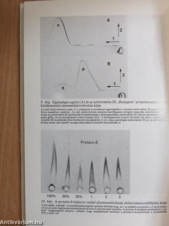 A hemosztáziszavarok klinikai vonatkozásai