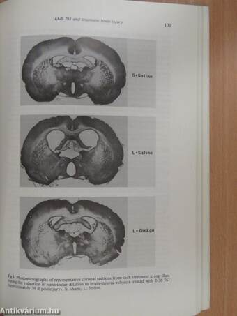 Effects of Ginkgo biloba Extract (EGb 761) on the Central Nervous System