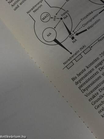 Tropfinfusionen in der Depressionsbehandlung