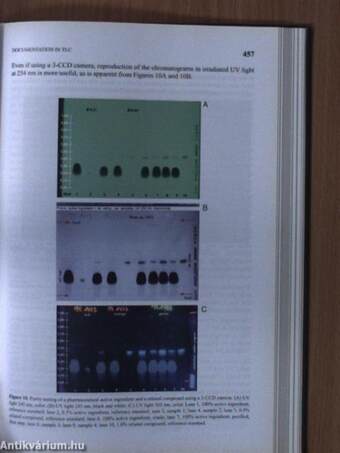 Planar Chromatography