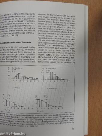 The Role of Hemodilution in Optimal Patient Care