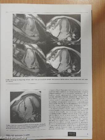 Orvosi Hetilap 2006/1-2. (fél évfolyam)