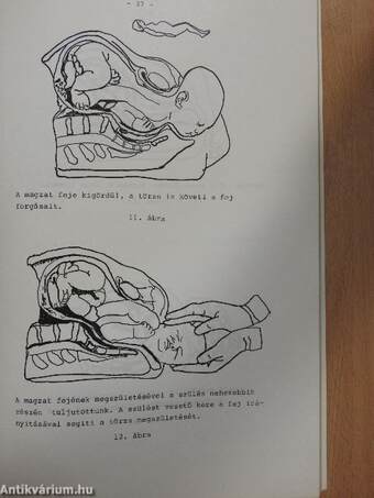 Terhességi psychoprophylaxis és autogén training