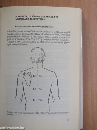 Electrocardiographia az orvosi gyakorlatban