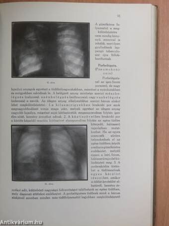 Belgyógyászati röntgen diagnosztika