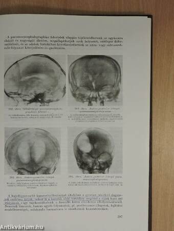 A radiologia alapvonalai