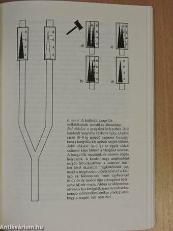 Neuropathiák